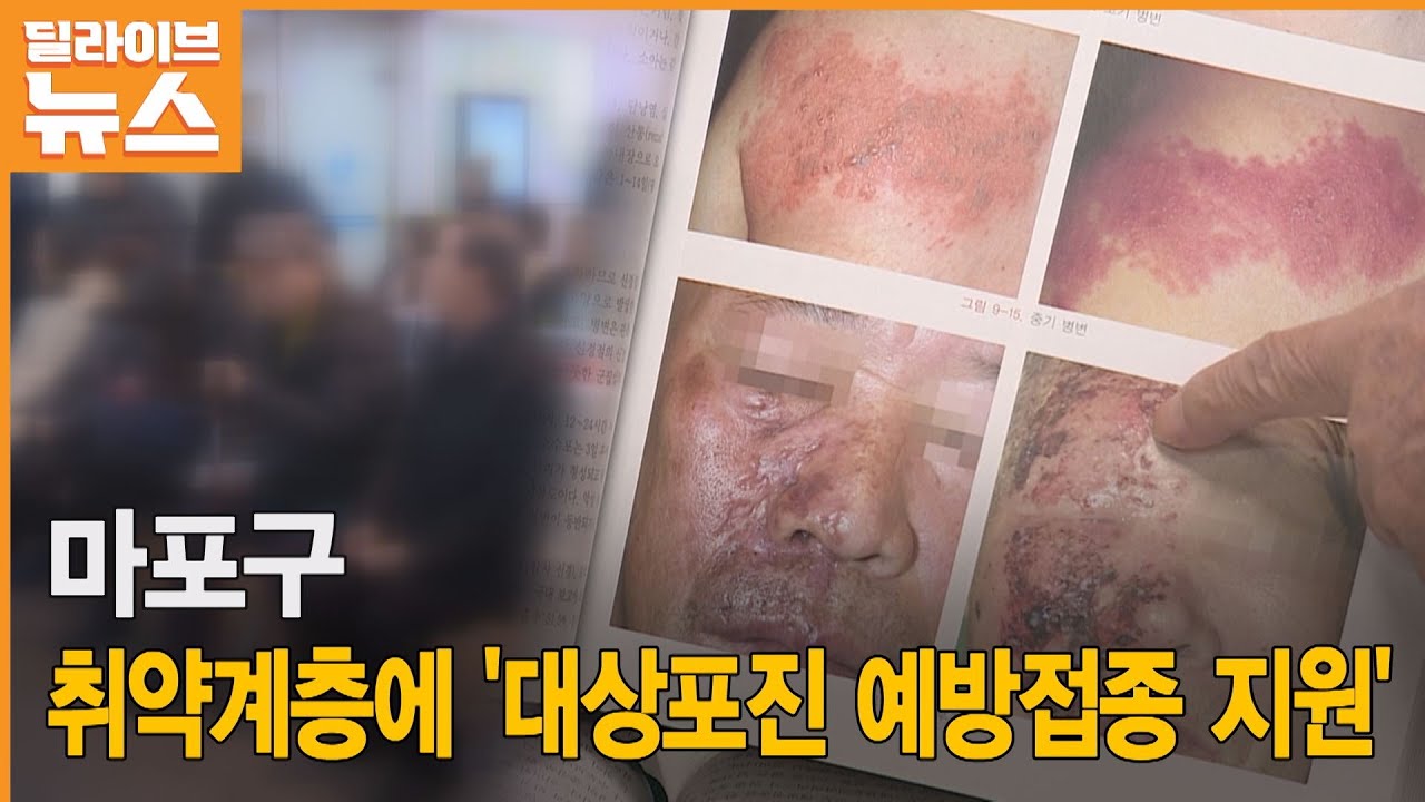 마포] 취약계층에 '대상포진 예방접종 지원' - Youtube