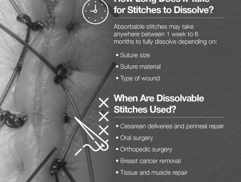 How Long Does It Take For Stitches To Dissolve After Getting Fixed A