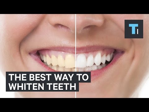 De beste manier om tanden witter te maken