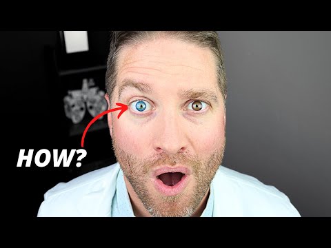 Heterochromia: Different-Colored Eyes - How Does This Happen?